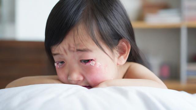 撞伤跌伤後运气
